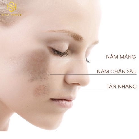 Tinh chất trị nám MESOESTETIC Melan Tran3x Concentrate 30mL 