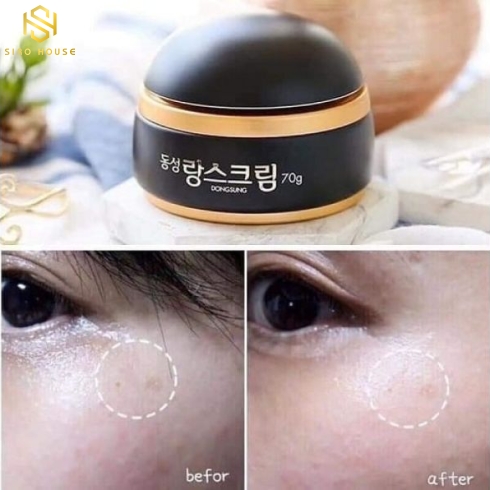 KEM DƯỠNG DONGSUNG RANNCE CREAM 50g