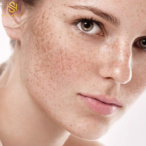 KEM TRỊ THÂM FIX DERMA SKARFIX-TX CREAM