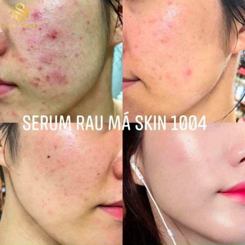 Tinh chất dưỡng da rau má SKIN1004 Madagascar Centella Ampoule 100mL 