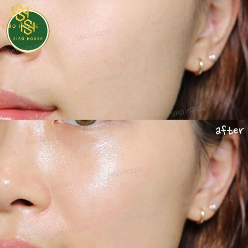 Tinh Chất Phục Hồi Da Dạng Viên Nang ESTEE Lauder Advanced Night Repair Ampoules