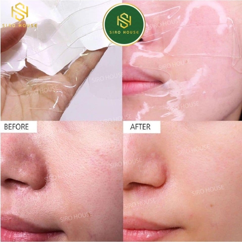 Mặt Nạ thạch Dưỡng Ẩm Chuyên Sâu CELDERMA Crystal Skin Mask