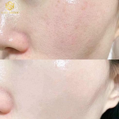 Nước Hoa Hồng The STEM Cell Skin Lotion 120ml