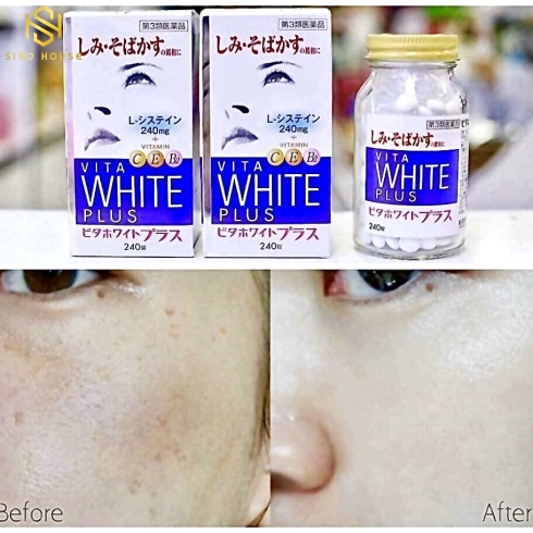 Viên Uống Trắng Da NEOVITA WHITE C PLUS – Hộp 240 Viên
