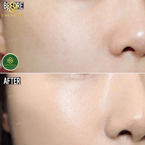 Kem chống nắng MARTI DERM Proteos Screen SPF 50+ Fluid Cream 40mL