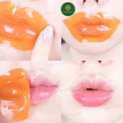 Mặt nạ dưỡng môi Prreti Real Vita HYDROGEL Lip Patch ( 30 MIẾNG)