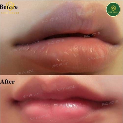 Son dưỡng môi CHOOSY Lips Treatment Nhật Bản