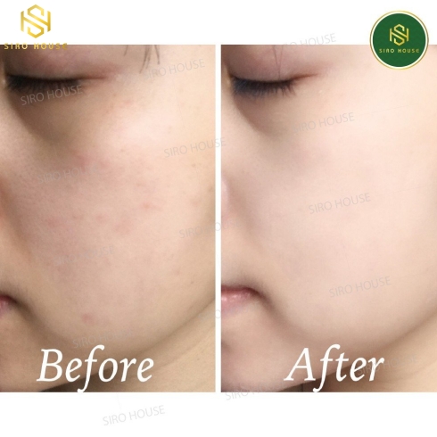 Nước hoa hồng dưỡng trắng da SUR.MEDIC + Super Glutathione 100 Bright Skin (145ml)