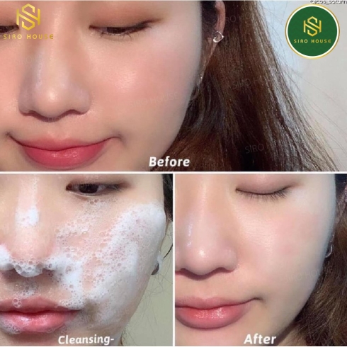 Sữa Rửa Mặt Tràm Trà DERLADIE Herbal Extract Care Deep Cleansing Foam (150mL)