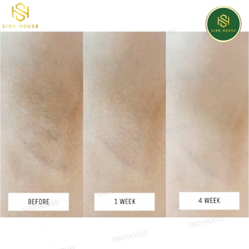 Serum dưỡng trắng vùng nách VASELINE Dry Serum White & Dry ( 50ml)