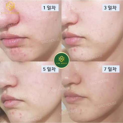 Sữa Rửa Mặt DR.G pH Cleansing R.E.D Blemish Clear Soothing Foam (150ml)
