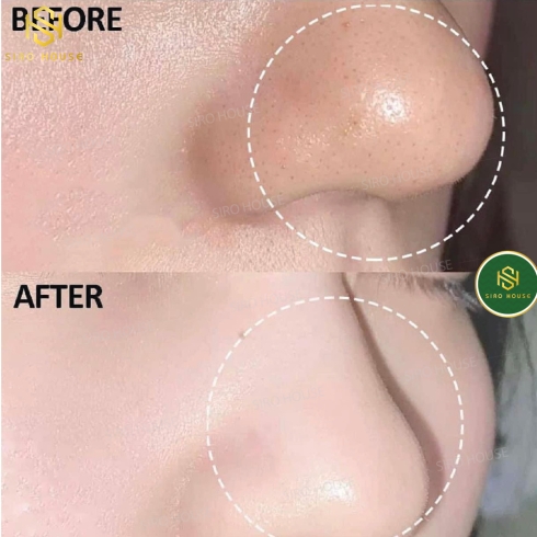 (Mẫu Mới 2023) Sữa rửa mặt INNISFREE VOLCANIC PORE BHA (150Gr)