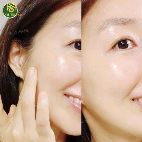 Kem dưỡng tinh chất vàng 24K chống lão hóa DR.PEPTI Silk Peptide 88 Cream EX (12G)