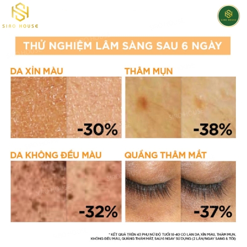 Tinh Chất Dưỡng Da Ban Đêm Garnier 10% Vitamin C Bright Complete Overnight  30ml