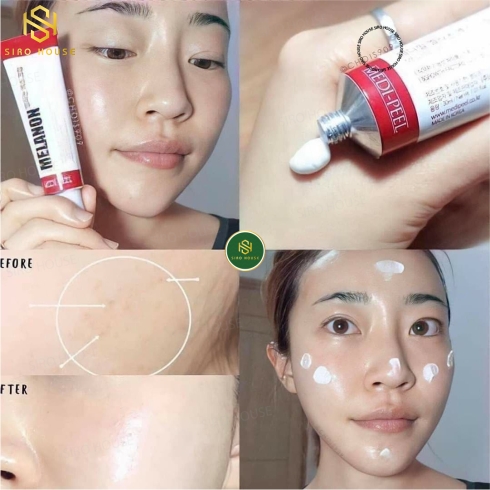 Kem dưỡng trị tàn nhang và mờ sẹo MEDI-PEEL MELANON X CREAM (30ML)