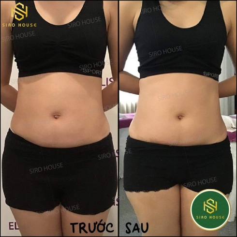 Kem Tan Mỡ Bụng SLIMMING Day Collagen + Olive Thế Hệ Mới