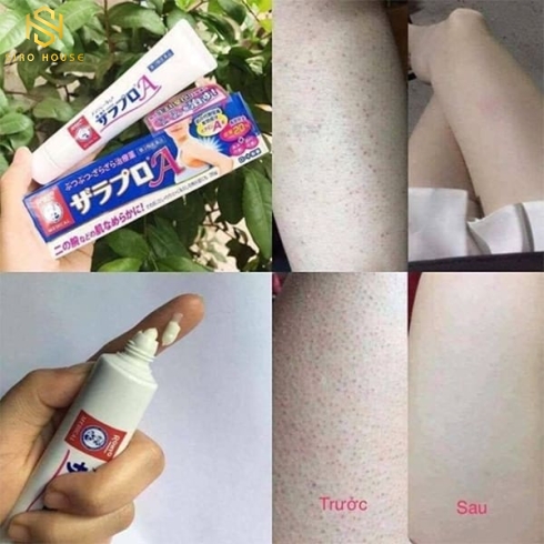 KEM TRỊ VIÊM NANG LÔNG ROHTO NHẬT BẢN