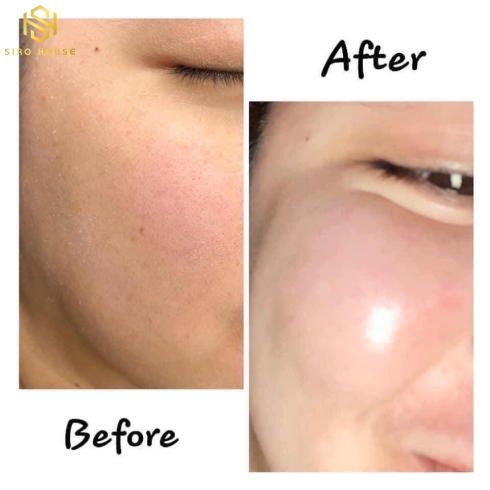 Tinh Chất Serum SMAS HA PLUS Hàn Quốc