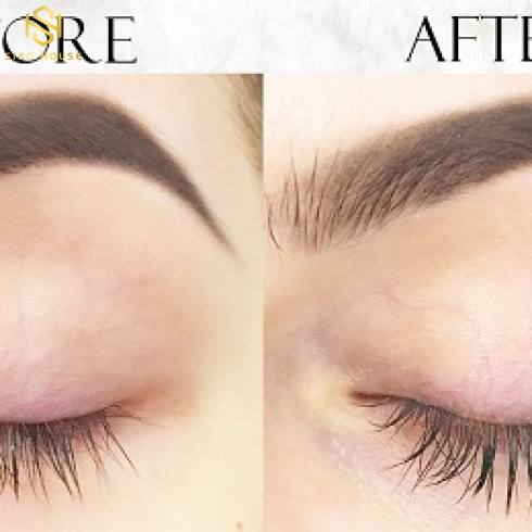 SERUM DƯỠNG MI FEG EYELASH