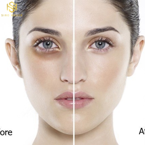 Kem trị thâm quầng mắt HADARIKI Kumargic Eye 20g