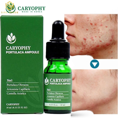 SERUM TRỊ MỤN CARYOPHY PORTULACA AMPOULE