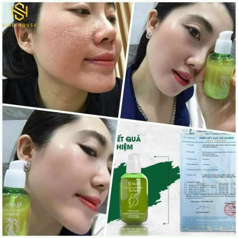 SERUM THAY DA NHÂN SÂM MQSKIN