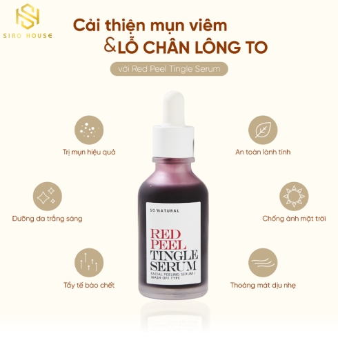 Tinh chất peel da sinh học SO NATURAL Red Peel Tingle Serum 35mL