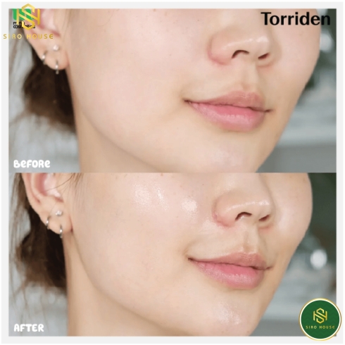 Mặt nạ TORRIDEN Low Molecular Hyaluronic Acid 27mL (1 miếng)