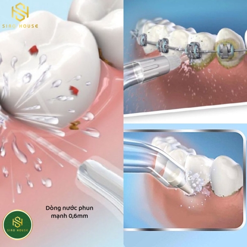 Máy tăm nước cầm tay VANLU