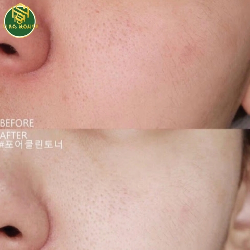 Nước cân bằng MARTI DERM Blooming Toner 200mL 
