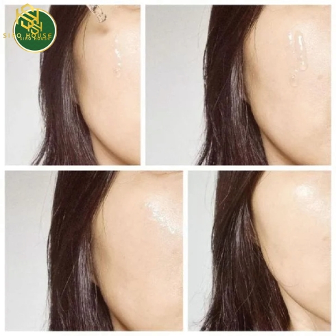 Tinh chất phục hồi cho da dầu PrettySkin Multi Hydra B5 Max Serum 50ml (Xanh đậm)
