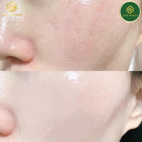 Tinh chất MARTI DERM Pigment Zero DSP Bright Ampoule (Hộp trắng 30 ống x 2mL)