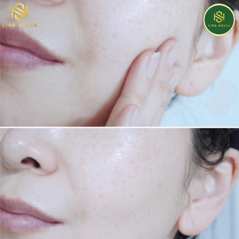 Tinh chất cấp ẩm 9WISHES Ampoule Serum Hydra Glowing Deep Hydration 25mL
