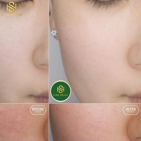 Nước cân bằng da PRETTYSKIN Multi Hydra B5 Calming & Repairing Toner 205mL 