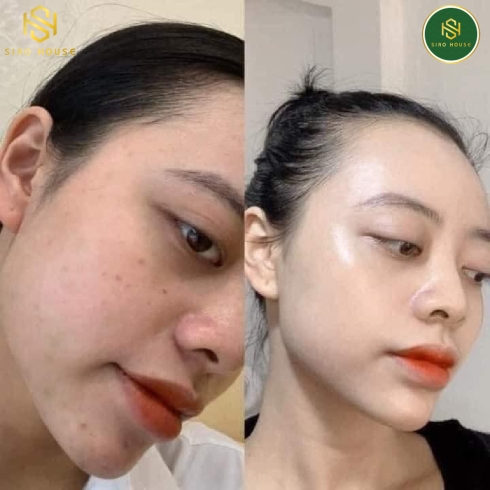 Tinh chất keo ong CNP LABORATORY Propolis Energy Active Ampure 15mL