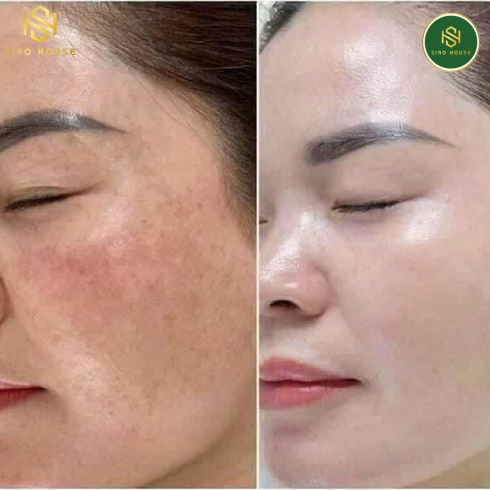 Kem trị nám MELA M Quu Whitening Magic Cream 50g