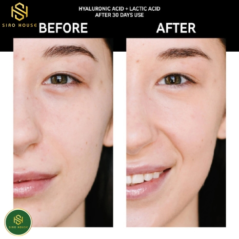 Nước hoa hồng TORRIDEN  Dive In Skin Booster 200mL