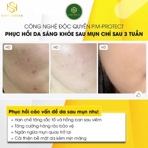 Tinh chất TIA
