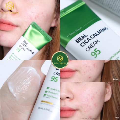 Kem dưỡng WELLAGE Real Cica Calming 95 Cream 80mL 