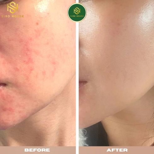Sữa rửa mặt EUCERIN pH5 Facial Cleanser Sensitive Skin 400mL