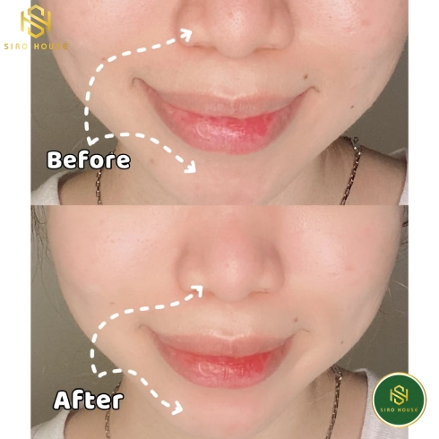 Sữa rửa mặt EUCERIN pH5 Facial Cleanser Sensitive Skin 400mL