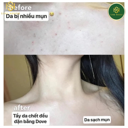 Tẩy tế bào chết toàn thân DOVE Body Love Night Recovery Body Polish 340g
