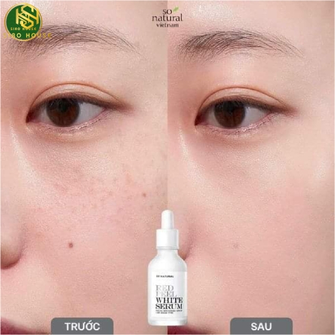Tinh chất dưỡng trắng SO