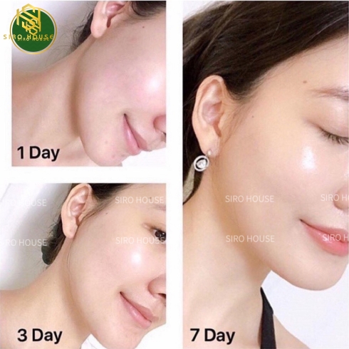 Set kem dưỡng OLAY Night & Day SPF 15