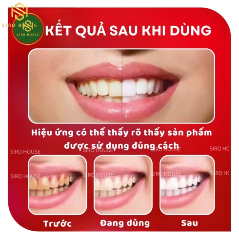 Kem đánh răng COLGATE Optic White Renewal Stain Prevention 116g 