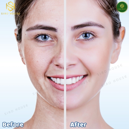 Viên uống trắng da, trị nám bổ sung vitamin C trị tàn nhang TRANSINO Premium White C Clear 90viên & 180viên