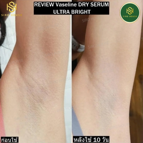 Serum dưỡng trắng vùng nách VASELINE Dry Serum #Ultra Bright 50mL 