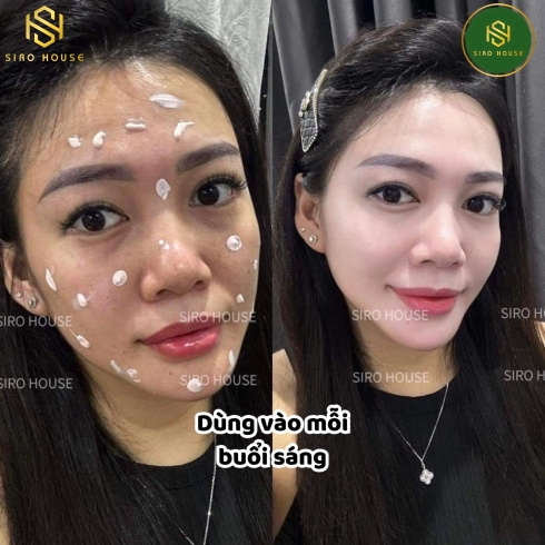 Kem dưỡng trị nám trắng da EIRLYS