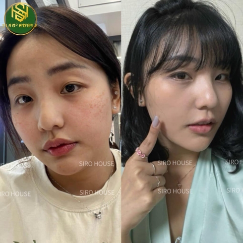 Kem dưỡng DONGSUNG Rannce Cream Plus 50g 