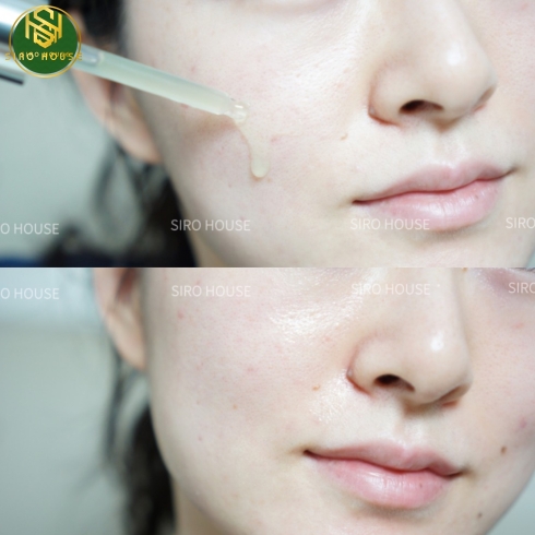 Tinh chất cà chua xanh thu nhỏ lỗ chân lông SUNGBOON Editor Green Tomato Pore Lifting Ampoule+ 40mL
